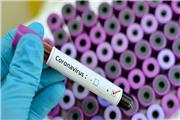 پزشک ایتالیایی: ویروس کرونا احتمالا پیش از ساخت واکسن، از بین می‌رود